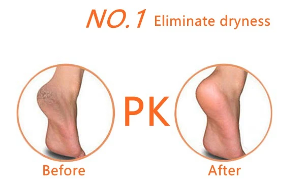 Silicone Gel Heel Protector Painful Squishy Anti-cracking Cushion Pad