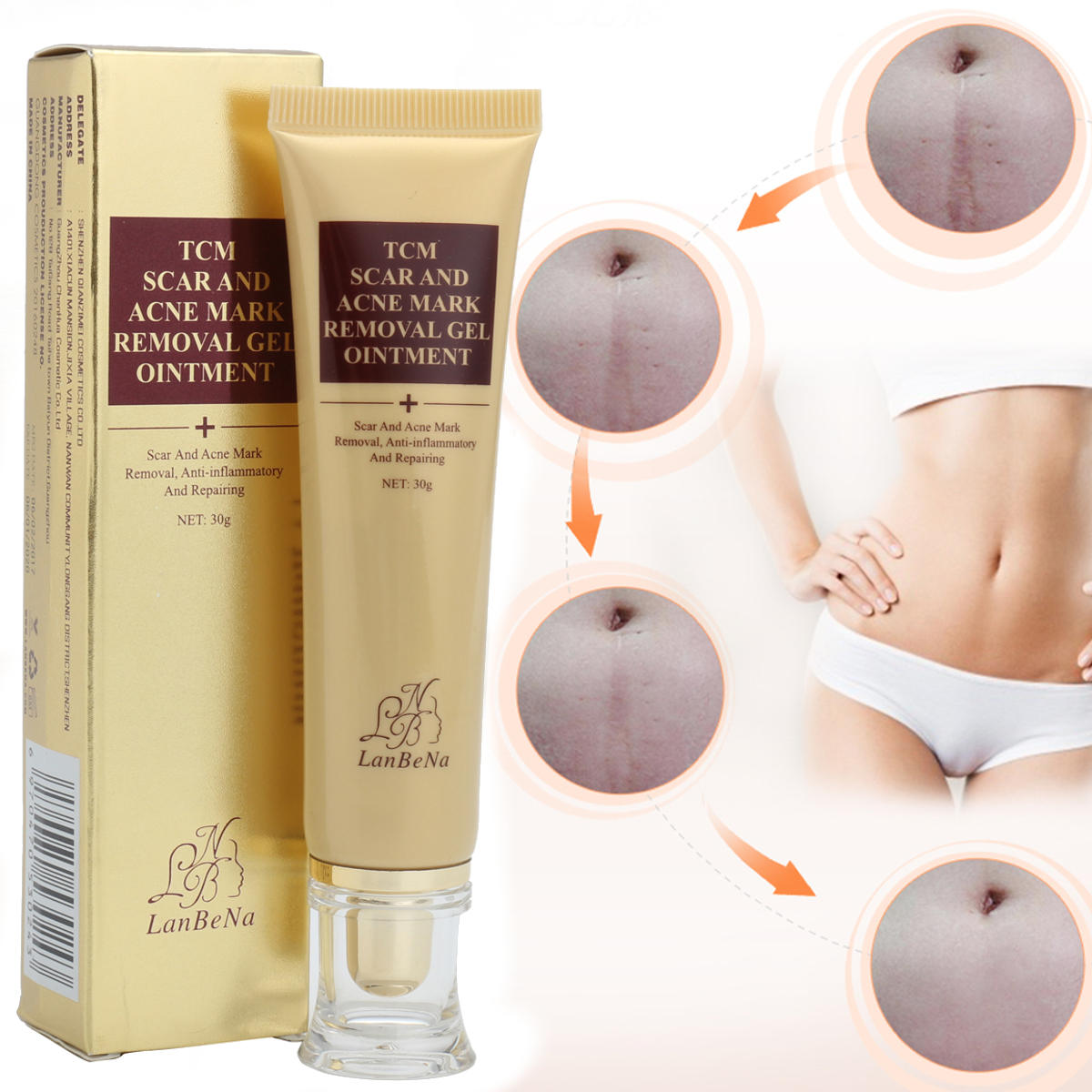 De cicatriz de creme de barbear remoção